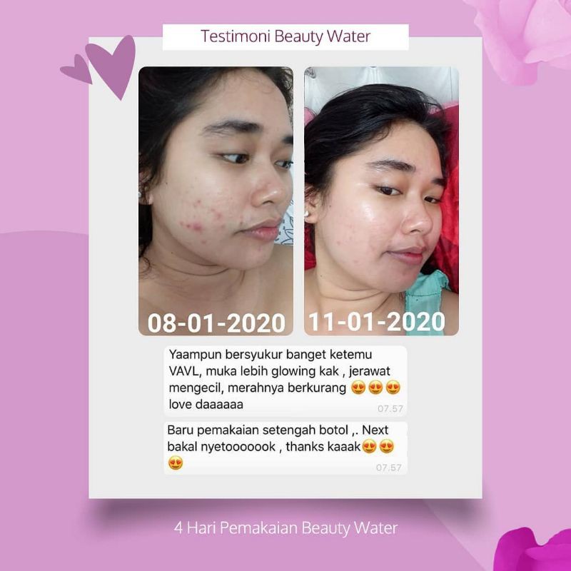 VAVL BEAUTY BY VIVALENTINE BLEMISH SERUM FACIAL CLEANSER BEAUTY WATER SUNSCREEN MASKER BPOM PURE WHITE SERIES