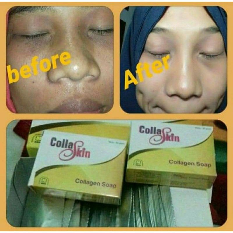 Sabun Collagen Nasa