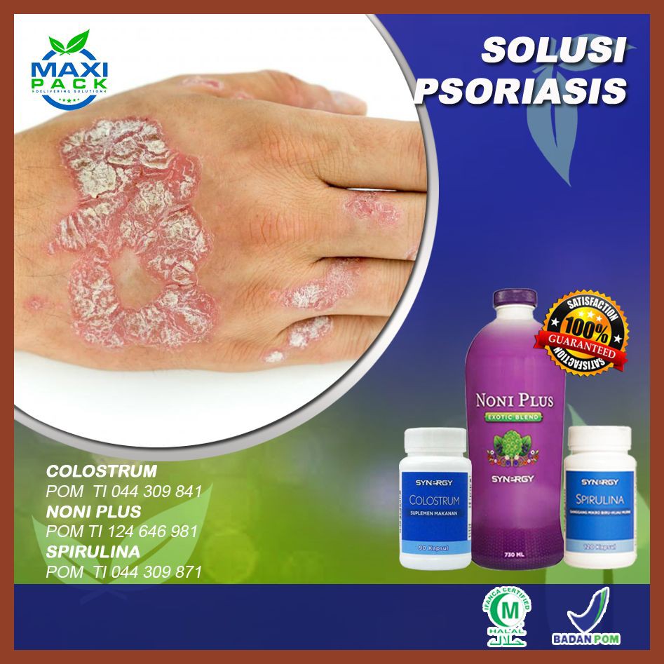 Herbal Atasi Penyakit Kulit Psoriasis 100% HERBAL