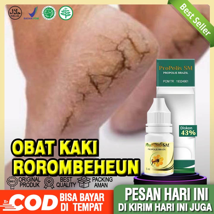 Obat Rorombeheun, Obat Oles Kaki Rayap, Propolis SM