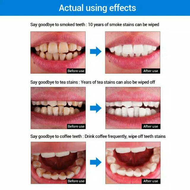 LANBENA Teeth Whitening Essence Powder Oral Hygiene Cleaning Serum / Yabanjing Pemutih Gigi Permanen / Pembersih Perontok Karang Gigi Ampuh Permanen