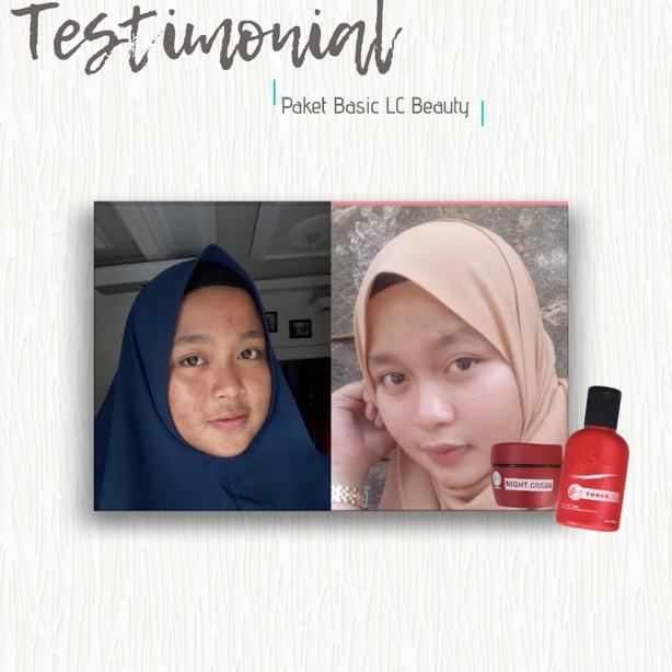 ➩ LCBEAUTY CREAM KF SKIN CARE KFSKIN ORIGINAL ㅍ