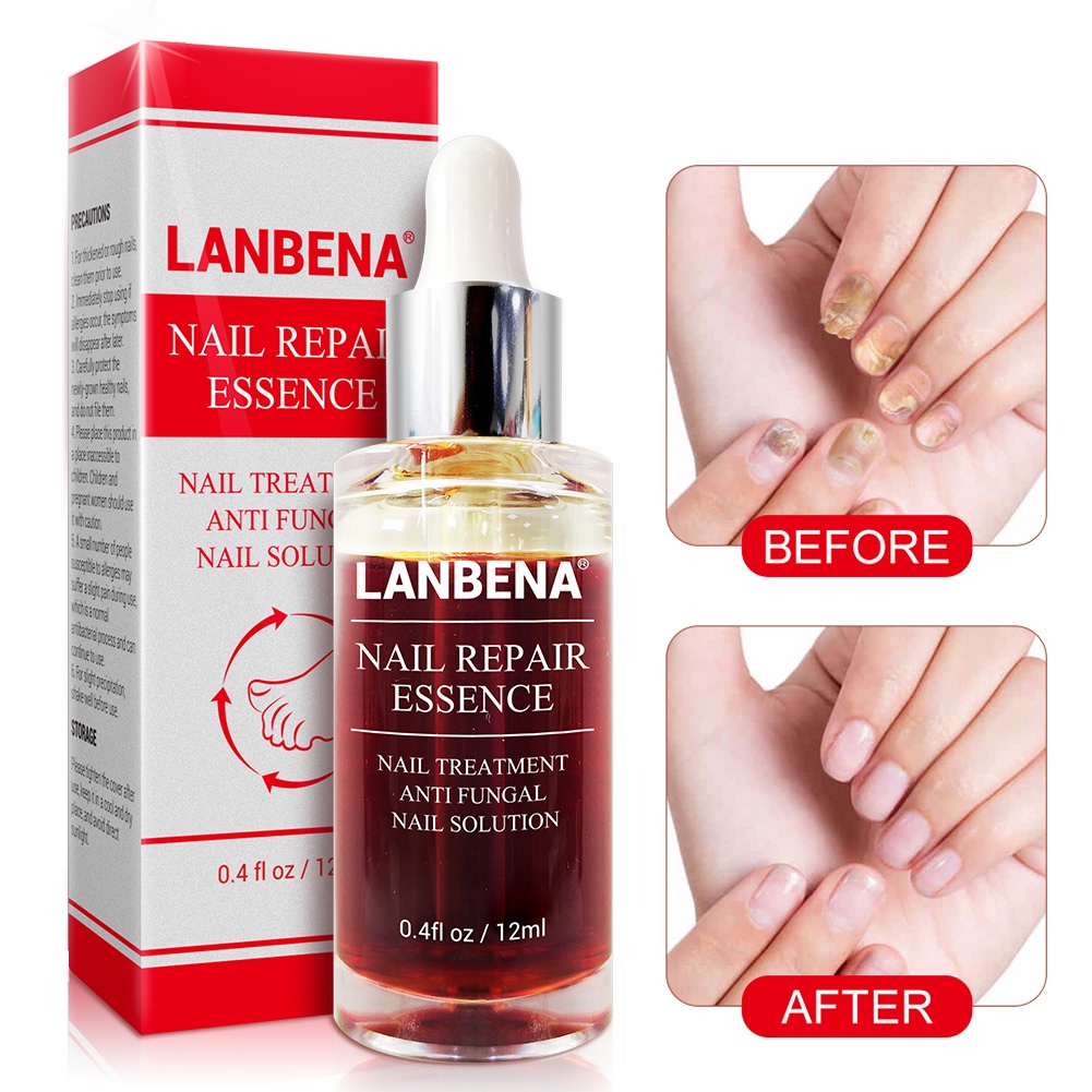 OBAT KUKU JAMUR DAN RUSAK OBAT KUKU KAKI OBAT JAMUR KUKU KAKI UNTUK PERAWATAN KUKU