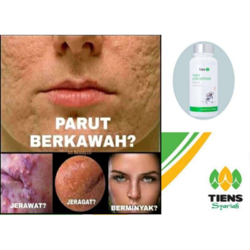 PENGHILANG BOPENG BEKAS JERAWAT & BEKAS LUKA