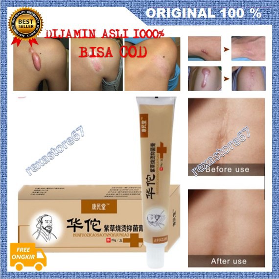 [BISA COD] Keloid Cream Luka Ampuh Atasi Keloid Original