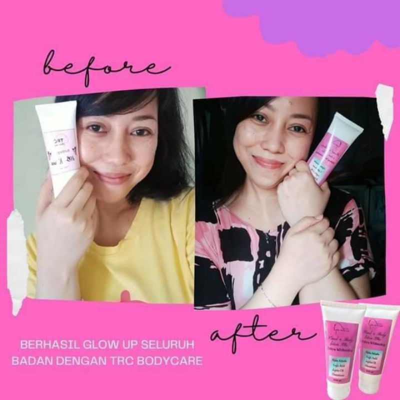 HB Lotion TRC Skincare