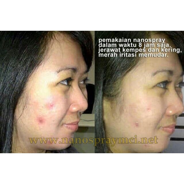 Nano Spray 2 Asli MCI