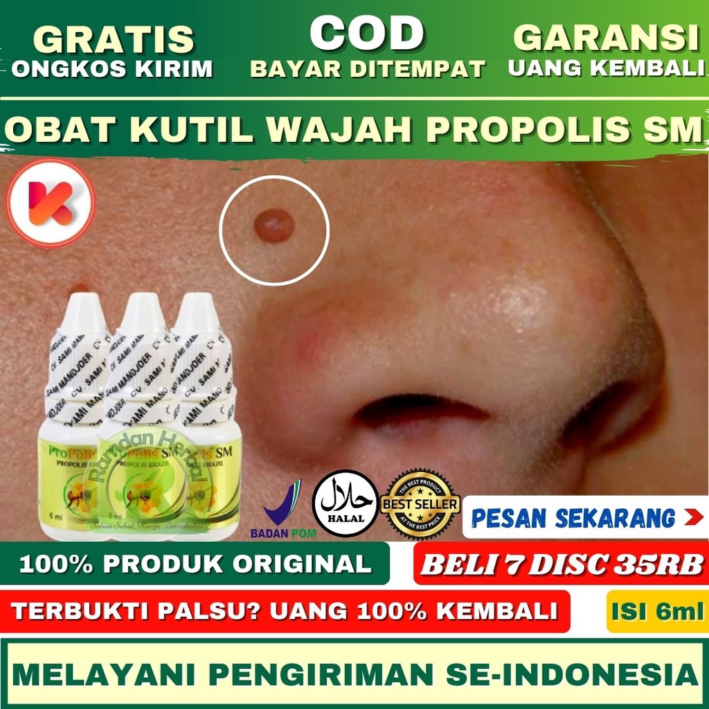 Obat Kutil Wajah Obat Kutil Wajah dan Leher Perontok Kutil Propolis sm