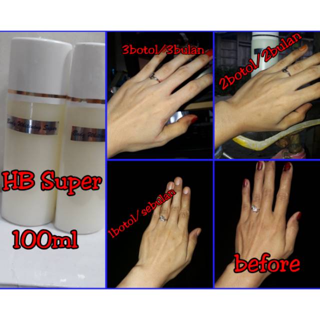 Hb whitening super anggur