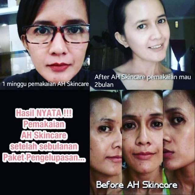 AH Miracle Skin Care