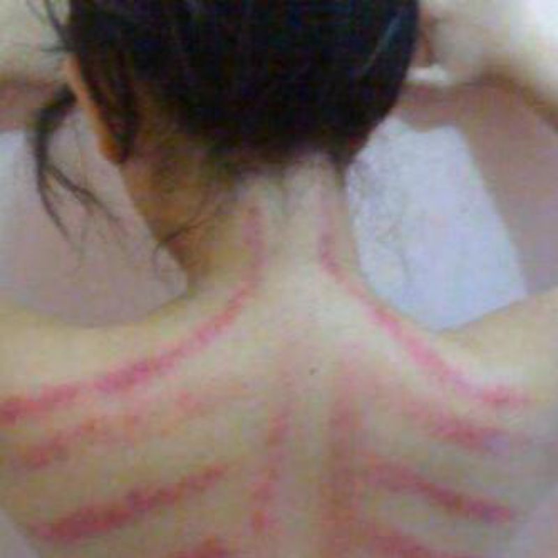 KEROKAN + PIJAT KEPALA & PUNGGUNG (KHUSUS WANITA) SE-JABODETABEK.