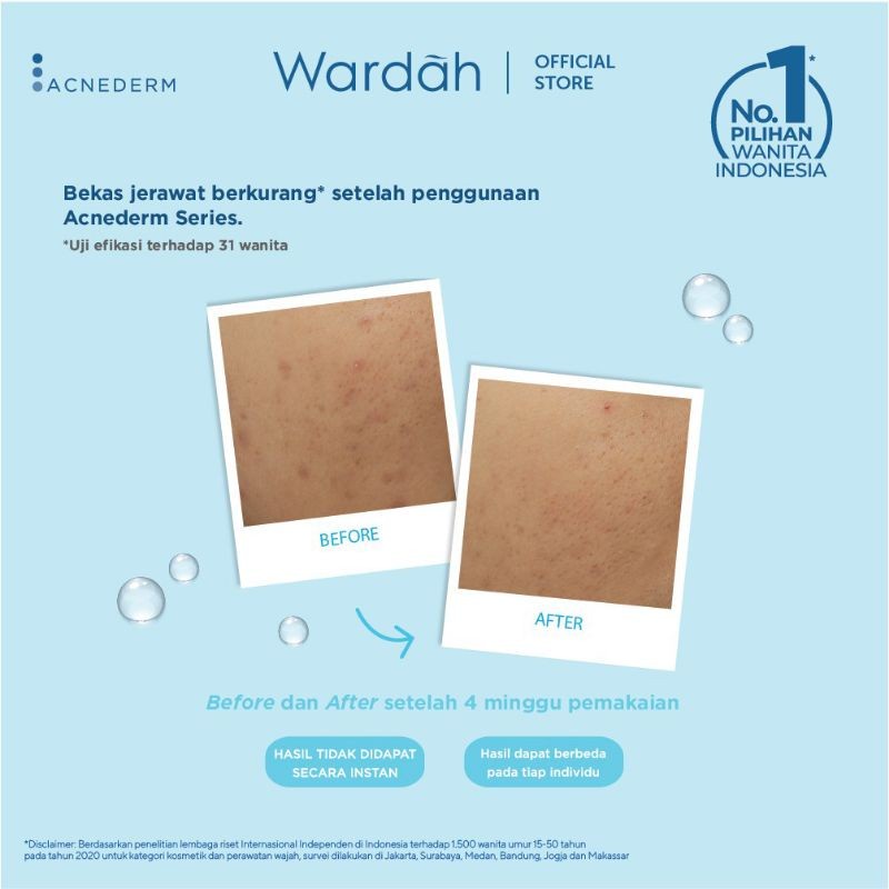 BEST SELLER!! Wardah Acnederm Pure Foaming Cleanser 60 ml - Pembersih Wajah Untuk Bantu Atasi Masalah Kulit Berjerawat