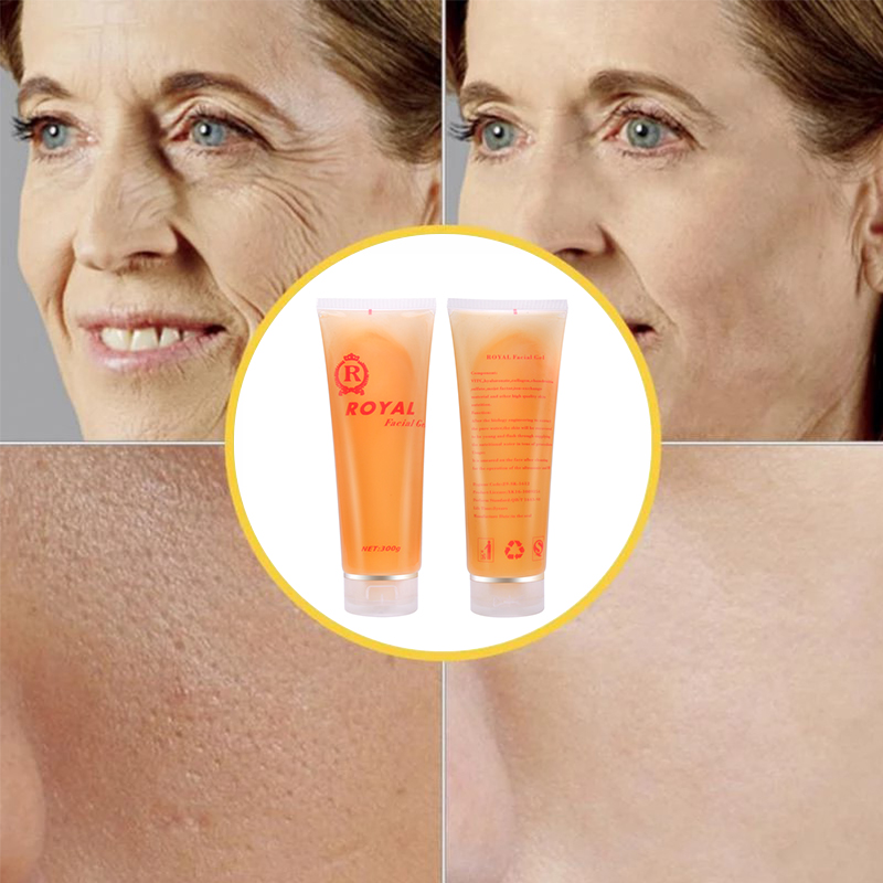 IPL RF Facial Royal Gold Gel Ultrasonic Lifting Tightening perawatan wajah