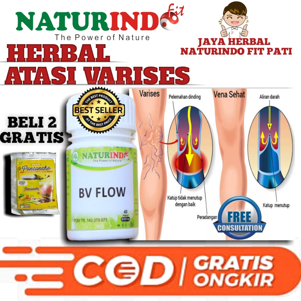 Naturindo Herbal Atasi Varises Obat Varises Paling Ampuh Herbal Otot Kaki Bengkak Di Betis Dan Kaki 