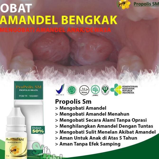 Obat Amandel Bengkak/Radang Amandel Anak/Dewasa Ampuh|Propolis Sm ORI