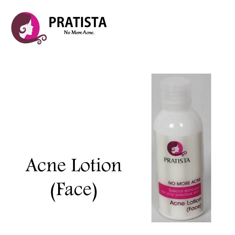 PRODUK LARIS Lotion Obat Jerawat - Acne Lotion (Face) Pratista TERLARIS