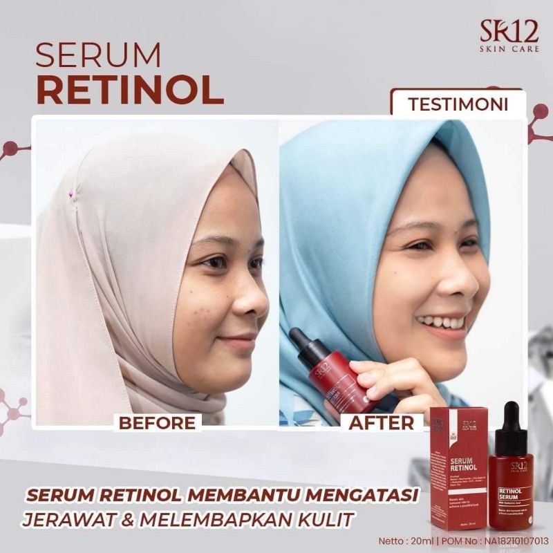 SERUM RETINOL SR12 GLOWING / SERUM WAJAH/ SERUM RETINOL BPOM/SERUM VIRAL PENGHILANG JERAWAT/ SERUM ANTI AGING