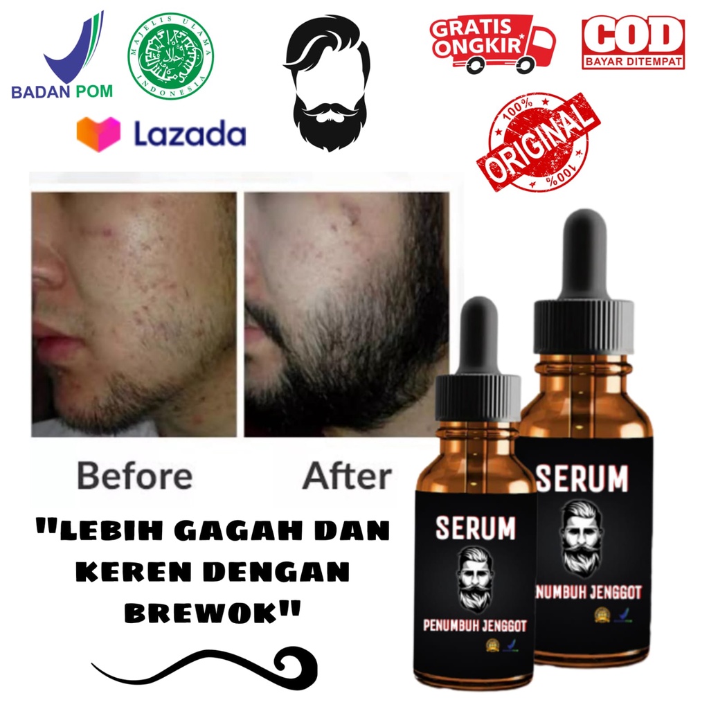 serum penumbuh jenggot/serum penumbuh jenggot minoxidil/serum penumbuh jenggot manjur/penumbuh jengg