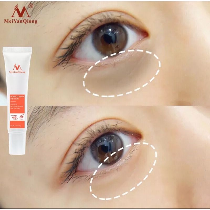 MeiYanQiong Herbal Probiotic Eye Cream Mengurangi Dark Circle-Anti Wrinkle-Anti Aging-Mengurangi Lingkaran Mata Hitam-15gr