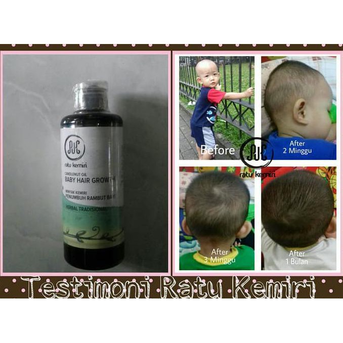 476G84Y7-Terlaris-Sale-- Minyak Kemiri Penumbuh Rambut Bayi Balita Anak