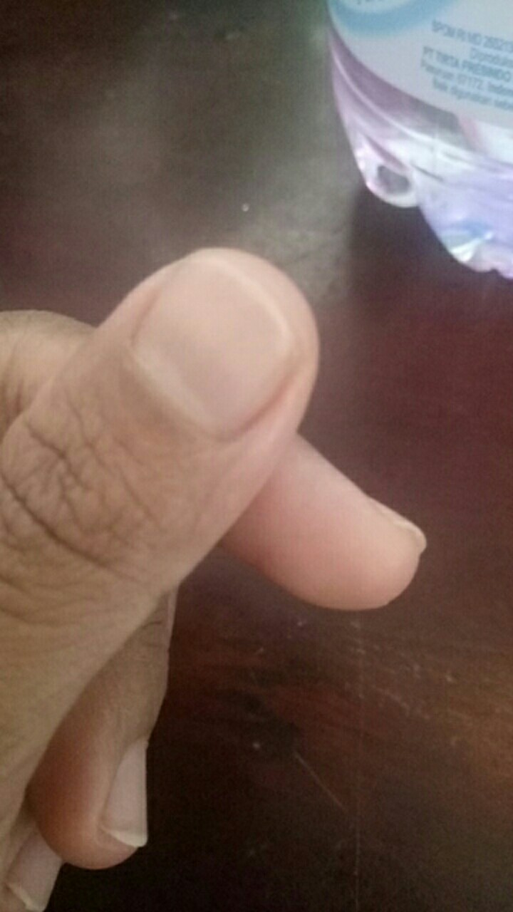 Batik Tunik Shibori Jumputan Terbaru Size S-3l / Hrb026 Yelbor Navbor / Biru Putih / Original..