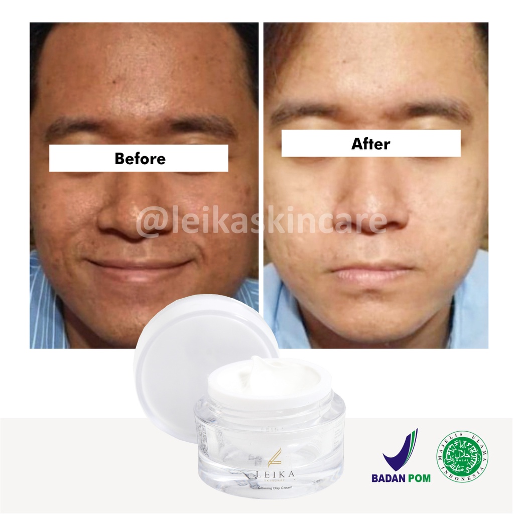 Day Cream Pemutih Kulit Wajah Pria Ampuh Cream Pria Kerim Pemutih Kulit Wajah Skincare Pemutih Kulit