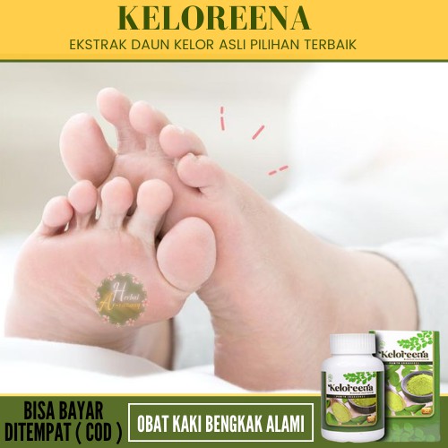 Obat Kaki Bengkak Dan Nyeri - Obat Kaki Betis Bengkak, Kaki Bengkak Karena Jatuh, Sakit Kaki Bengkak