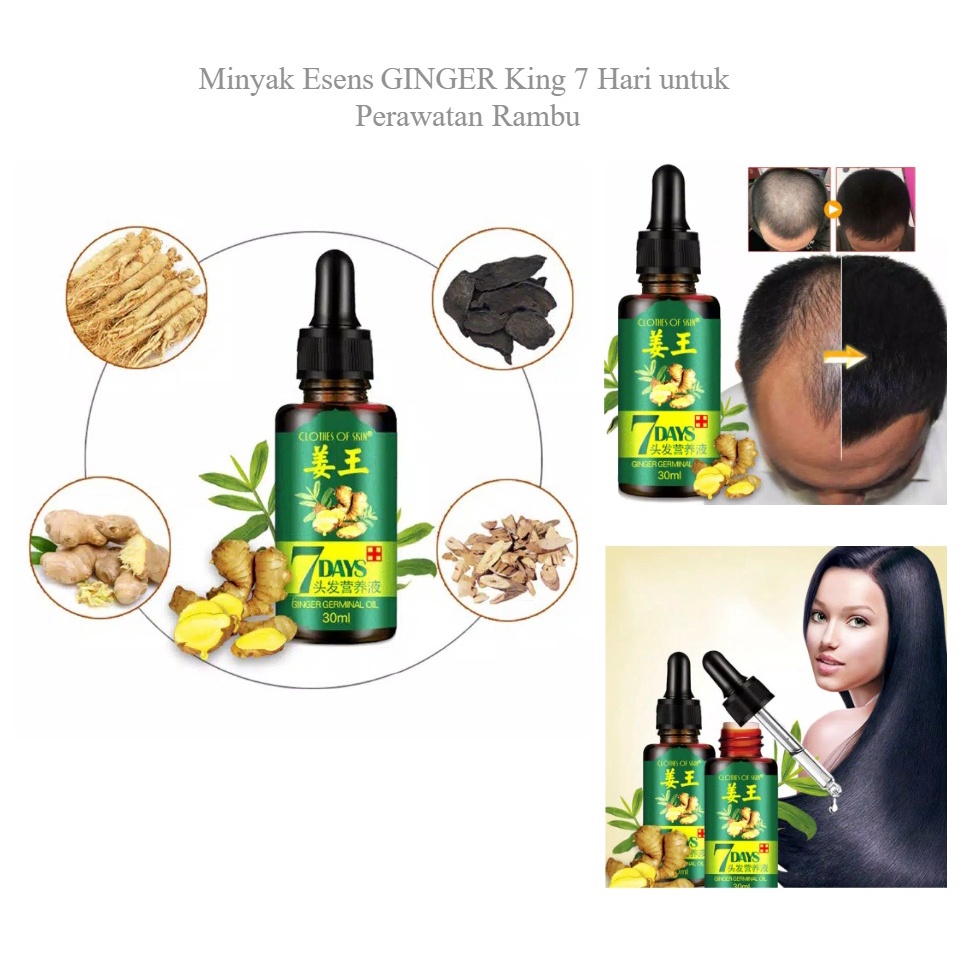 GINGER KING OIL 30ml Clothes of Skin Ginger Germinal Oil Minyak Penumbuh Rambut dalam 7 Hari