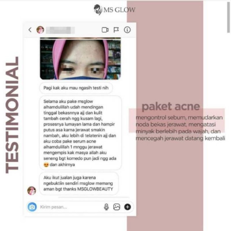 Paket Acne MS Glow Paket wajah 100% original perawatan wajah menghilangkan jerawat(bisa cod)