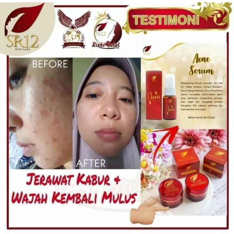 SERUM JERAWAT BPOM AMPUH..!! ACNE SERUM SR12 / OBAT PENGHILANG JERAWAT / SERUM RADANG JERAWAT