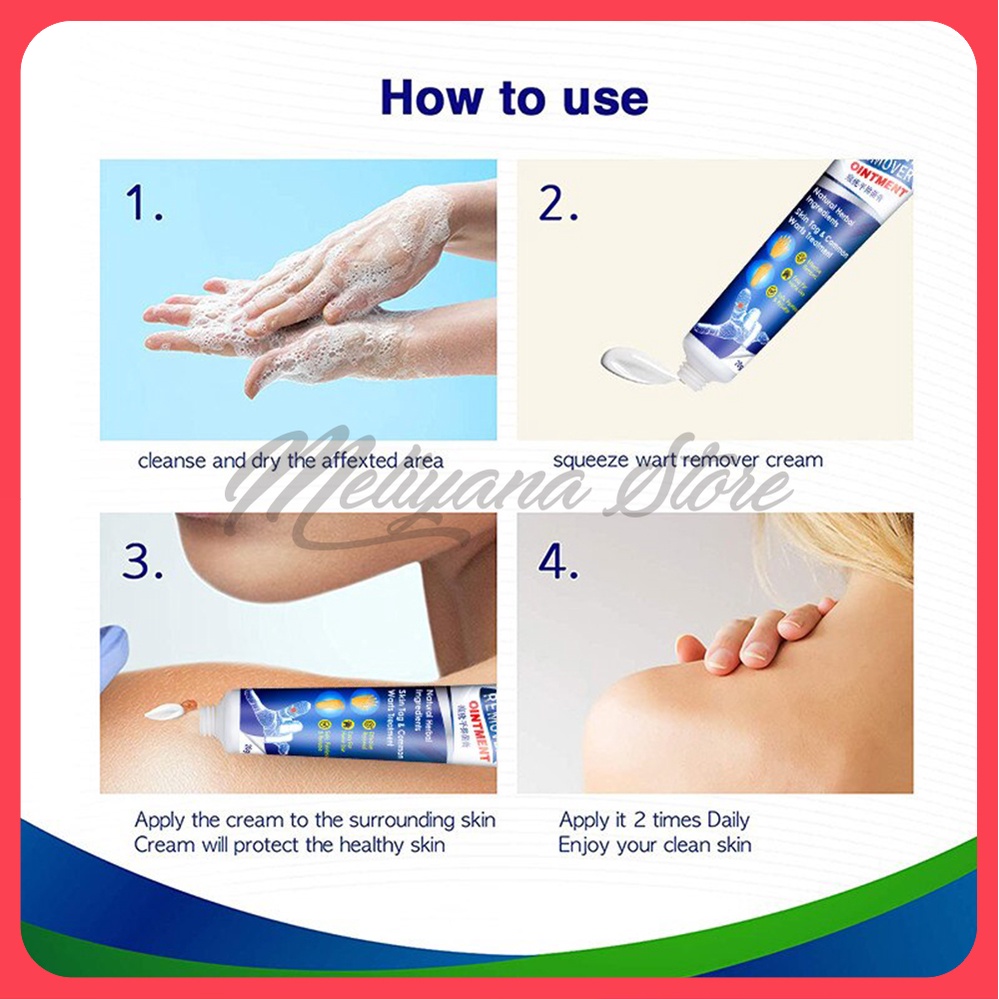 Skin Tag Remover Menghilangkan Kutil Tahi Lalat Mata Ikan - SUMIFUN Wart Remover Ointment