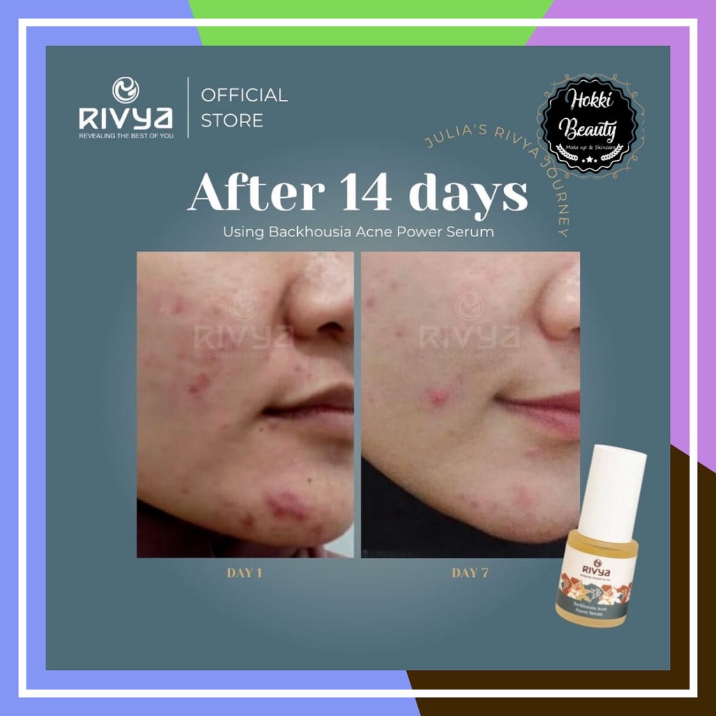 RIVYA Backhousia Acne Power Serum 20ml Serum Untuk Jerawat Aman Untuk Busui dan Bumil