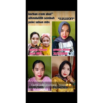 Sabun Multi Beauty/Multibeauty/Sabun Madu/Sabun Spirulina/Sabun Kecantikan/Sabun Glowing//Sabun Mult