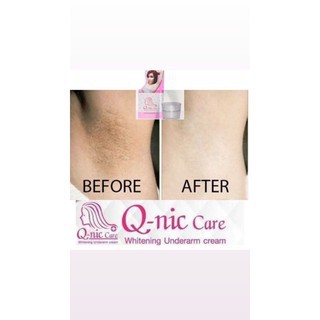 Qnic Care Whitening Underarm Cream Pemutih Ketiak | Krim Ketiak | Deodoran | Qnic Care Serum