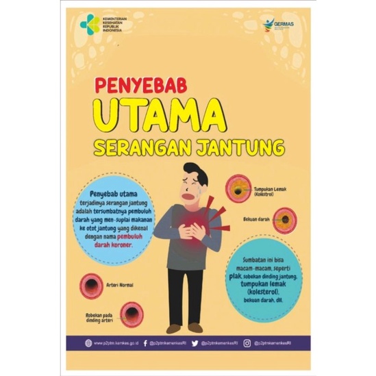 

Poster Kesehatan | Poster Penyebab Utama Serangan Jantung