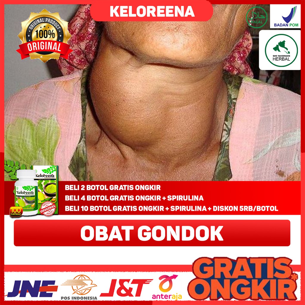 Obat Herbal Gondok, Obat Herbal Gondongan, Obat Herbal Tiroid Membeasr - Obat Herbal Keloreena