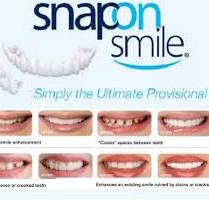 Terjangkau SNAP ON SMILE GIGI PALSU TERLARIS 100% ORI ..