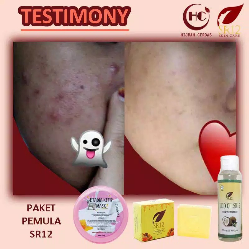 ETAWA KEFIR MASK SR12 BPOM/KEFIR ETAWA MASK SR12/KULIT BERMINYAK&amp;BERJERAWAT/KEFIR MASK SUSU KAMBING