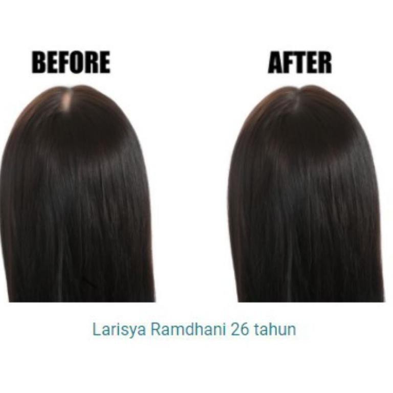 Trend's 2121 Kageherbal Havita Asli Original Spray Penumbuh Rambut Vitamin Rambut Rontok M27M1 ,..|