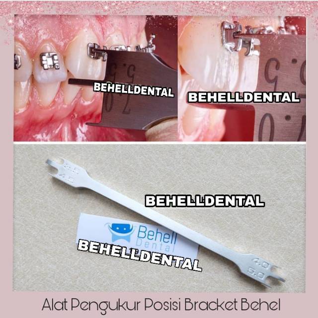 Bracket Height Gauge Orthodontic / Bracket Position / Alat Pengukur Bracket