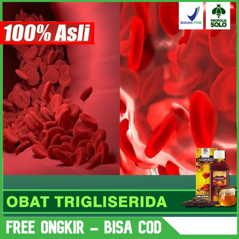 

Obat Trigliserida Tingi, Yang Aman Herbal Alami Di SOLO Sari Kurma dan Madu Terlaris Bisa COD