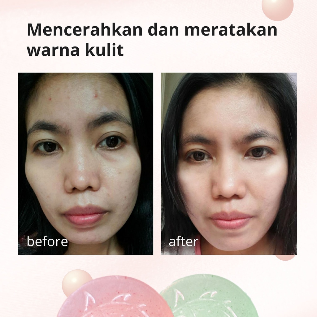 Lauralee Salmon DNA Sabun Wajah & Tubuh Pemutih 2in1 1 Box isi 2pcs Bright & Acne-6