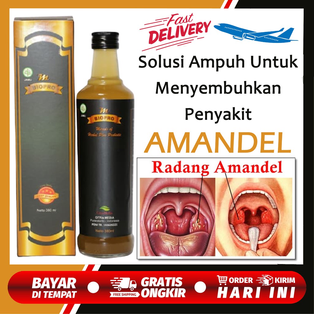 Obat Amandel | Obat Amandel Paling Ampuh | Obat Amandel Anak | Obat Amandel Anak Ampuh Tanpa Operasi