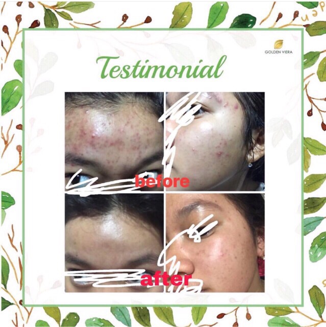 (READY) SABUN HERBAL GOLDEN VIERA KEMASAN TERBARU Paket 5pcs paket 10pcs FREE GIFT