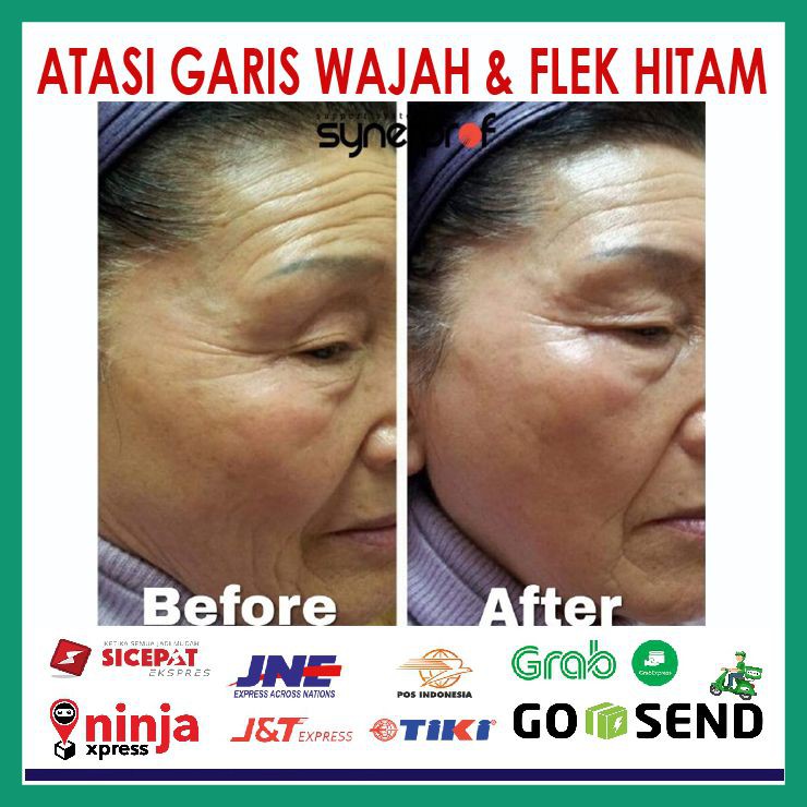 Cream Krim Penghilang Kerutan Wajah | Trulum Mengencangkan Wajah Anda