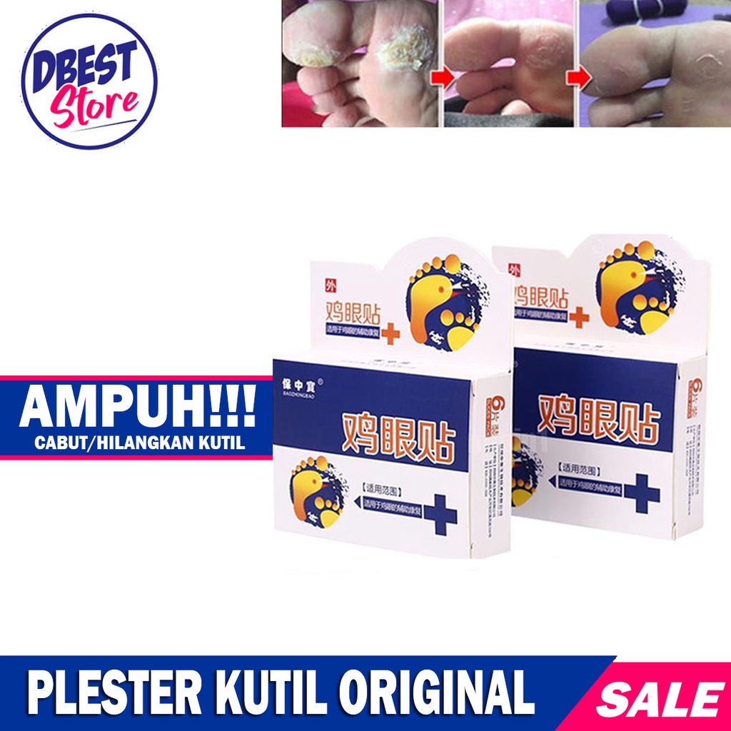 (1Box isi 6 Pcs) Plester Obat Kutil &amp; Mata Ikan / Kapalan Koyo Kutil / Plester Obat Penghilang Kutil