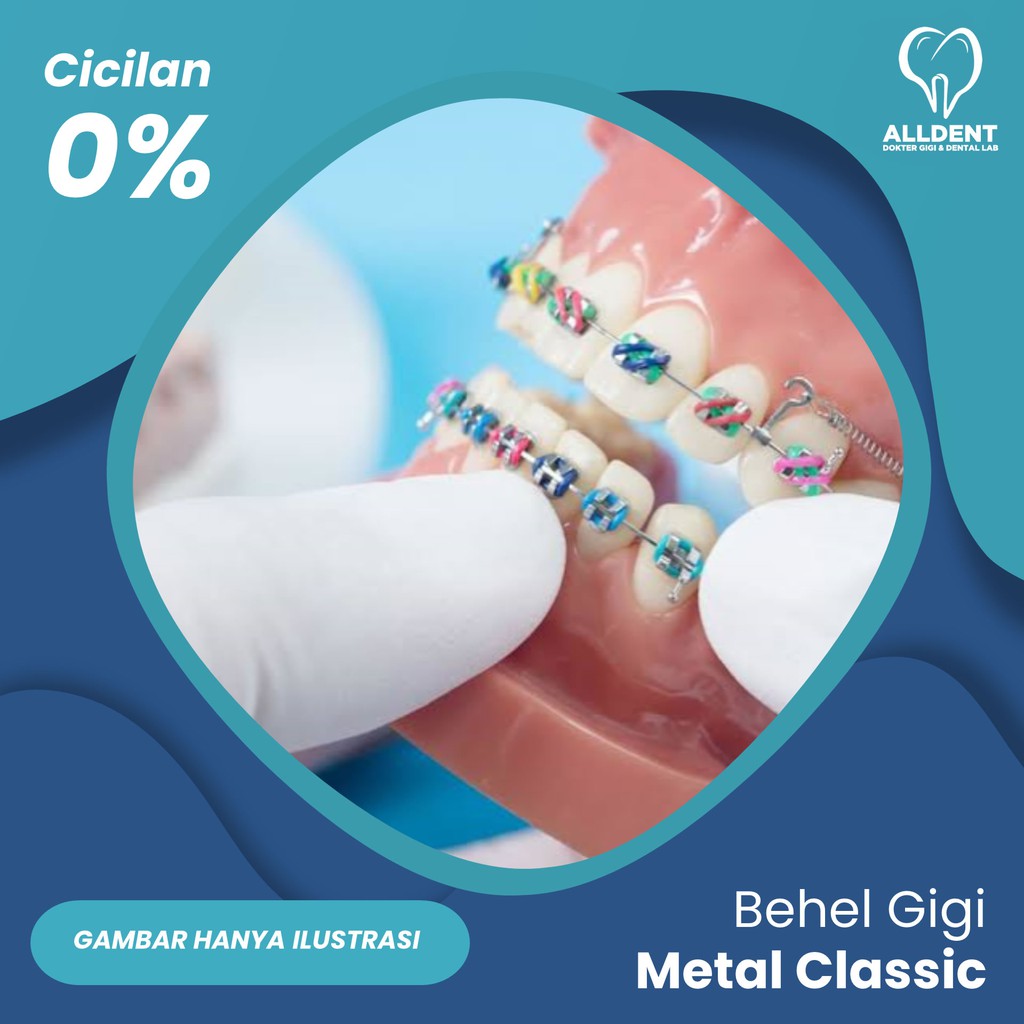 Behel Gigi Metal USA