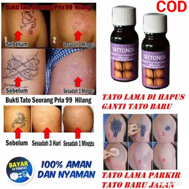 OBAT PENGHILANG TATTO PERMANEN TATTONOX ORIGINAL