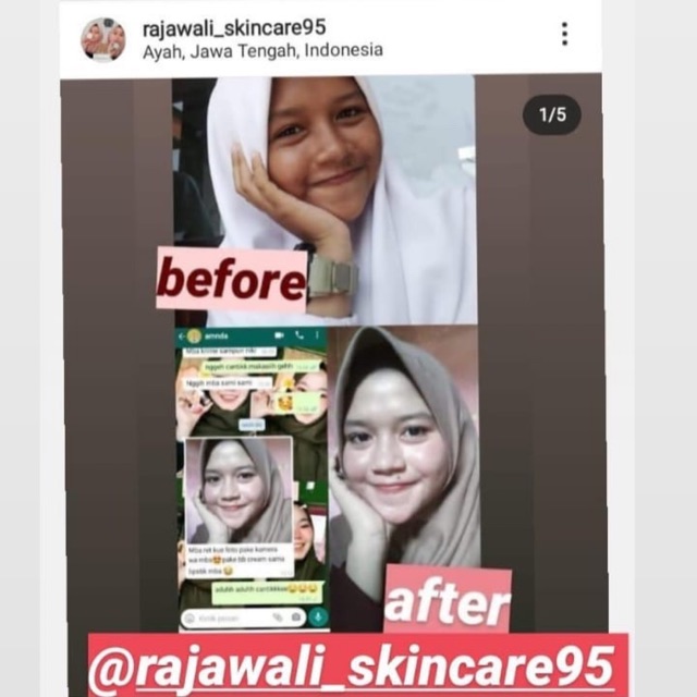 rajawaliskincare95