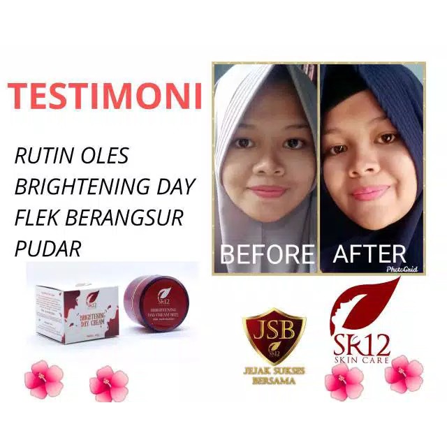 Brightening Cream SR12 Day &amp; Night Cream Pencerah Wajah dan Pelindung dari Sinar UV BPOM